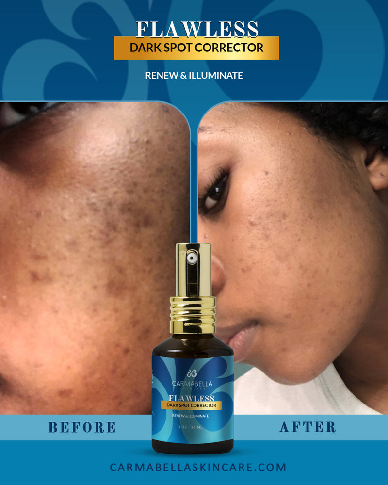 Natural Skincare Real Results Flawless Dark Spot Corrector | CarmaBella Skincare LLC